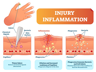 injury inflammation