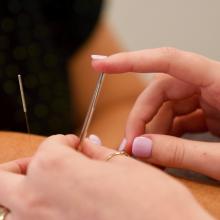 dry needling